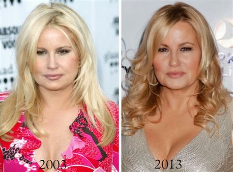 jennifer coolidge botox|jennifer coolidge before plastic surgery.